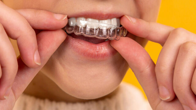 dentists in reno, cosmetic dentistry reno, family dentistry, reno invisalign, invisalign reno, braces alternative reno